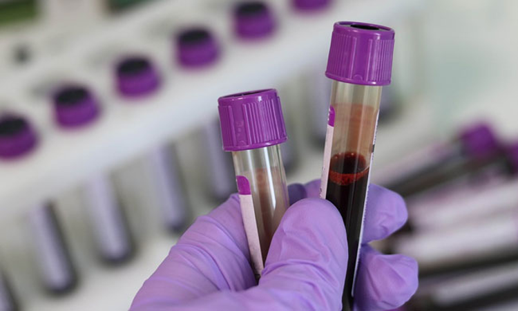 Increased Acquittals: High Court Sets 1-Year Outer Limit To Establish Fully Equipped Forensic Labs In Punjab, Haryana & Chandigarh Increased Acquittals: High Court Sets 1-Year Outer Limit To Establish Fully Equipped Forensic Labs In Punjab, Haryana & Chandigarh