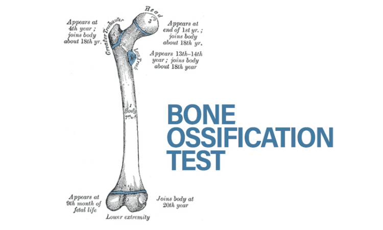 Demystifying The Bone Ossification Test In Criminal Jurisprudence Demystifying The Bone Ossification Test In Criminal Jurisprudence