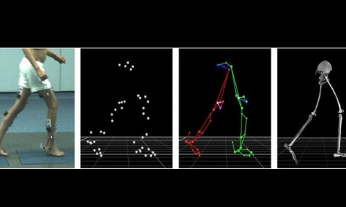Understanding The Gait Test And Its Impact On Criminal Trials