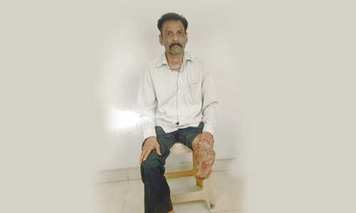 Frivolous Petition: Bombay HC Imposes ₹50K Cost On JIK Industries For Delaying Adjudication In Watchmans 15-Yr-Old Compensation Claim