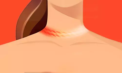 Ligature/Strangulation Mark On The Neck – Is It Really Suicide/Murder? Ligature/Strangulation Mark On The Neck – Is It Really Suicide/Murder?