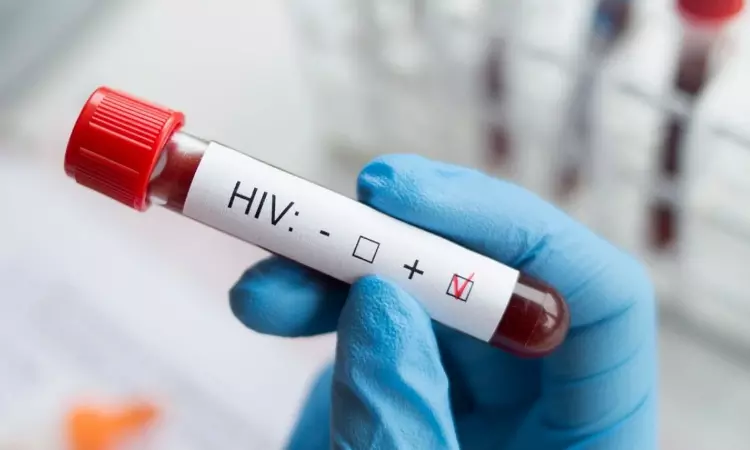 Noting That Accused Is HIV Positive, Meghalaya High Court Grants Bail To A Woman Booked Under NDPS Act Noting That Accused Is HIV Positive, Meghalaya High Court Grants Bail To A Woman Booked Under NDPS Act