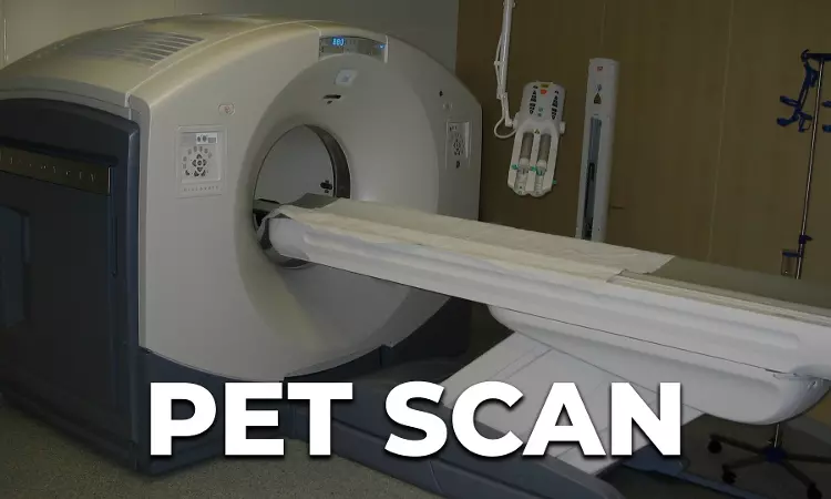 PET Scan Couldnt Have Saved Patient Who Approached Hospital At Cancer Stage II B, Maharashtra State Commission Dismisses Complaint Against Jupiter Hospital PET Scan Couldnt Have Saved Patient Who Approached Hospital At Cancer Stage II B, Maharashtra State Commission Dismisses Complaint Against Jupiter Hospital