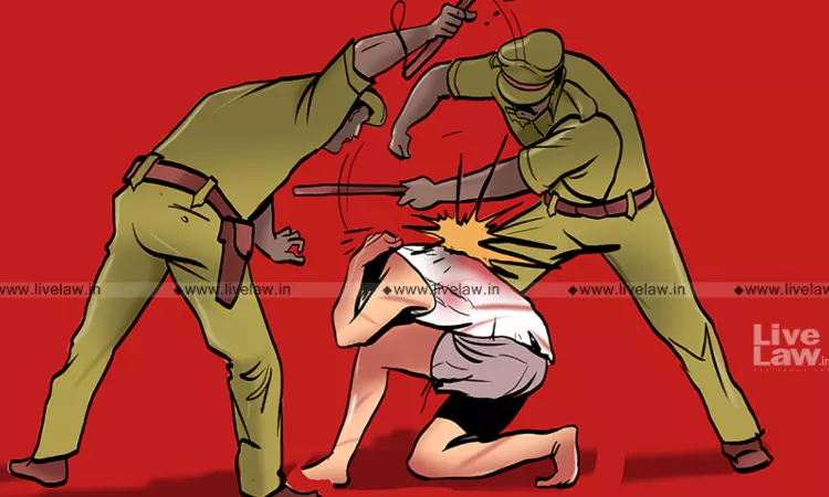 Uttarakhand High Court Orders Suspension Of Deputy Jailor, Constable Over Alleged Assault On A Prisoner Uttarakhand High Court Orders Suspension Of Deputy Jailor, Constable Over Alleged Assault On A Prisoner