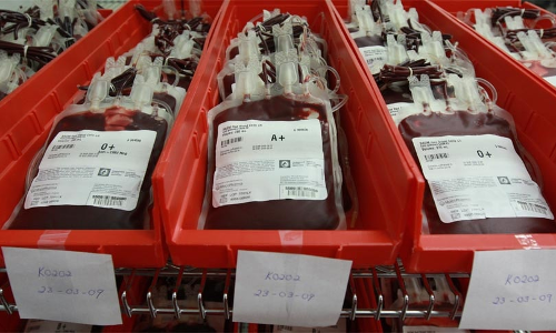 SC Issues Notices On A  Plea To Regulate Blood Banks & Revise NBTC Guidelines [Read Order]