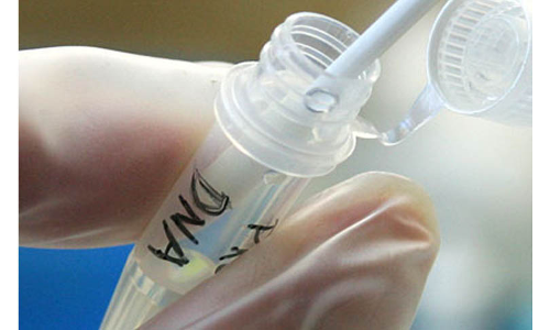 DNA Test Cant Be Ordered To Prove Bigamy When Paternity Is Not Directly In Issue: Madras High Court