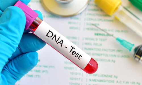 AP High Court Declines Fathers Plea For DNA Test Of Children To Prove Alleged Adultery By Wife In Divorce Case