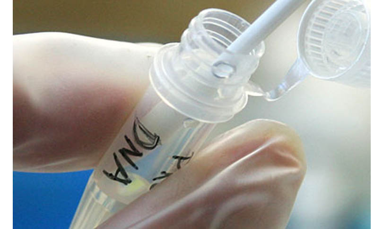 DNA Test Cant Be Ordered To Prove Bigamy When Paternity Is Not Directly In Issue: Madras High Court DNA Test Cant Be Ordered To Prove Bigamy When Paternity Is Not Directly In Issue: Madras High Court
